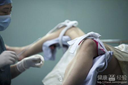 人流,术前需要准备什么